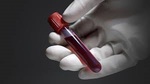 Blood Tests for Body Analysis in Dubai