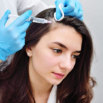 PRP For Hair in Dubai