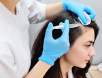 ACell PRP Therapy Hair Loss in Dubai