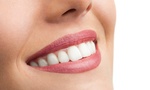 Dental Clinic Dubai